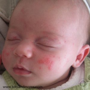 Winter care for Babies