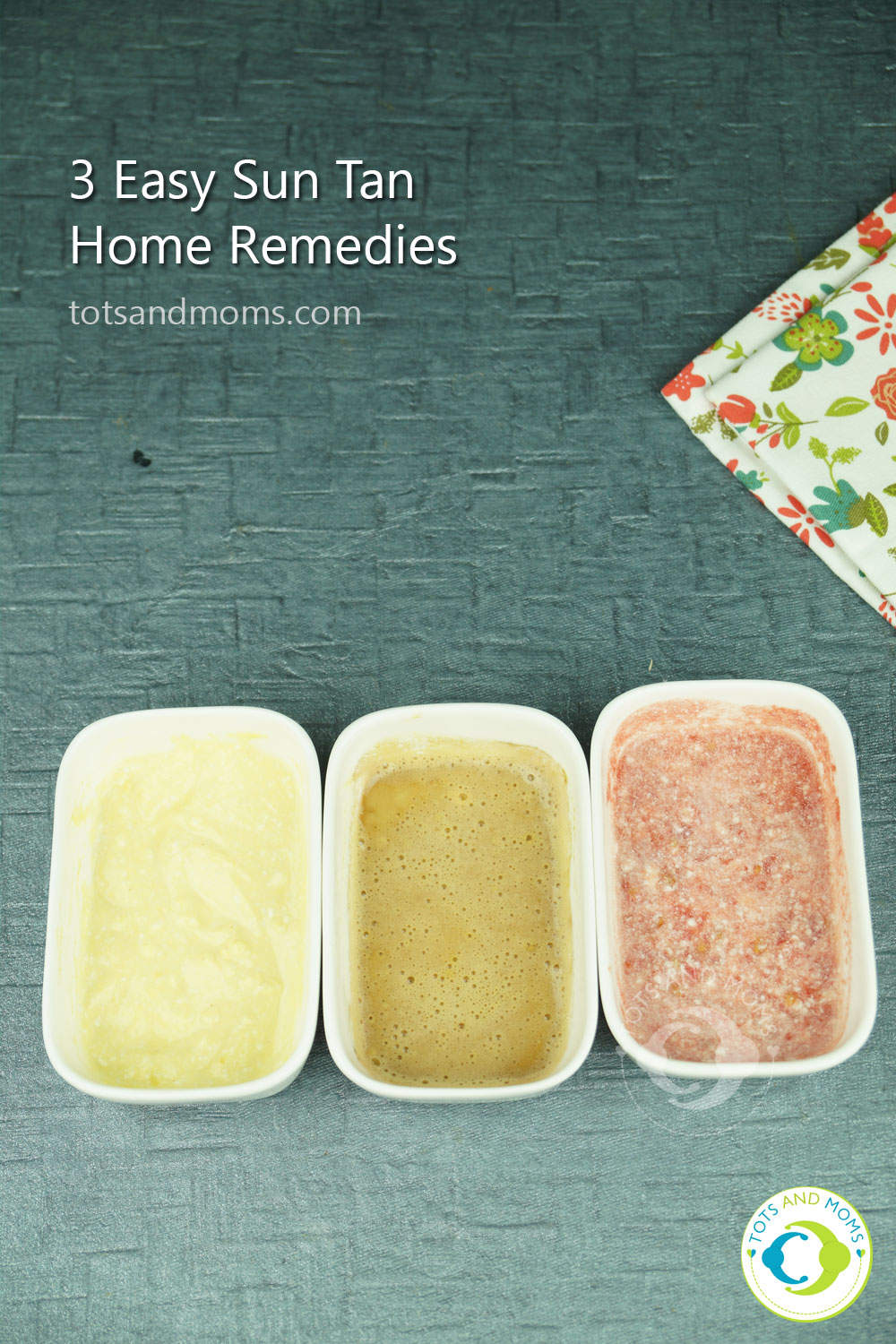 3 Easy Sun Tan Home Remedies for Kids and Moms kannada hindi