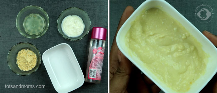 3 Easy Sun Tan Home Remedies for Kids and Moms kannada hindi